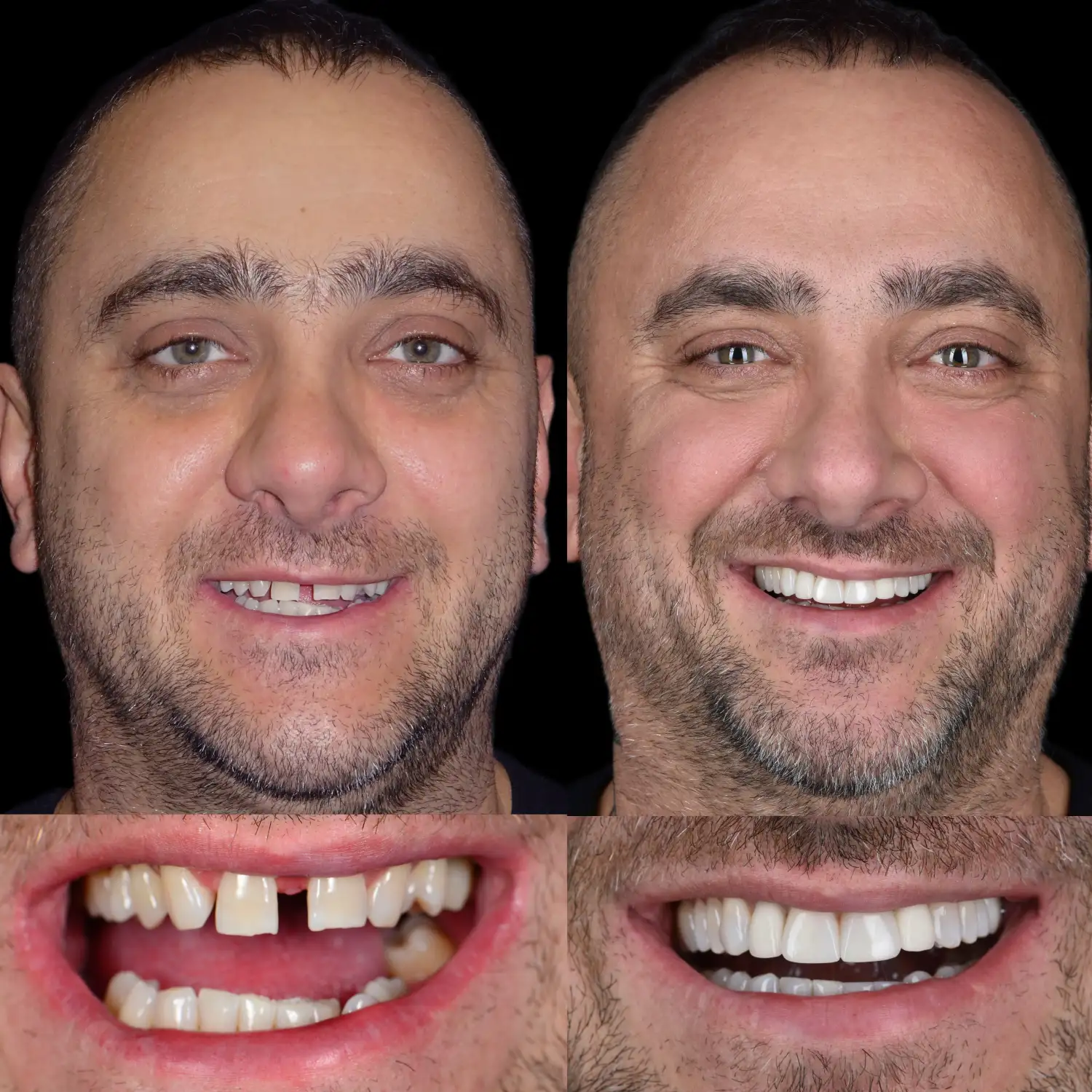 unident-union-metamorfozy-implantologia-1 (1)