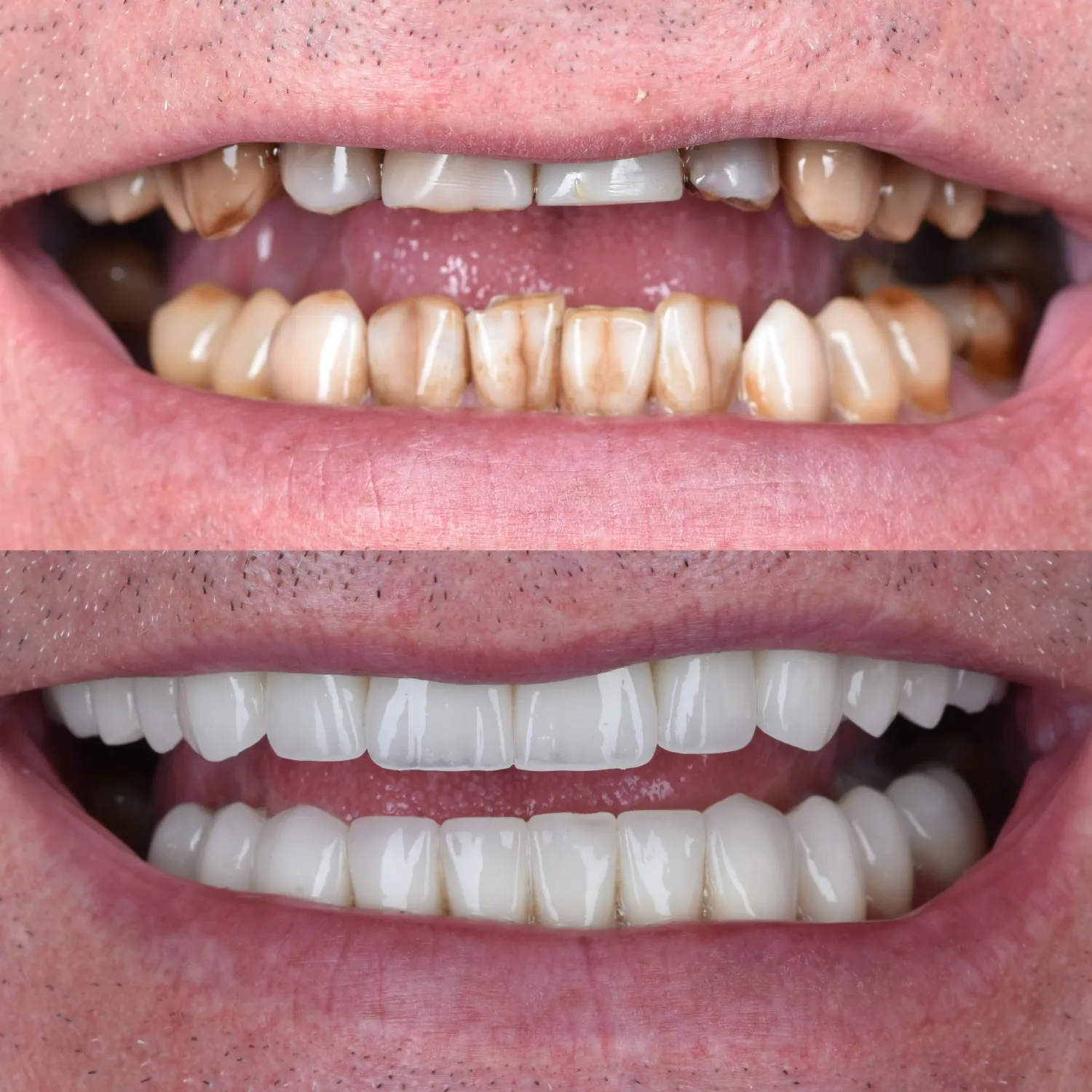 unident-union-metamorfozy-implantologia-2