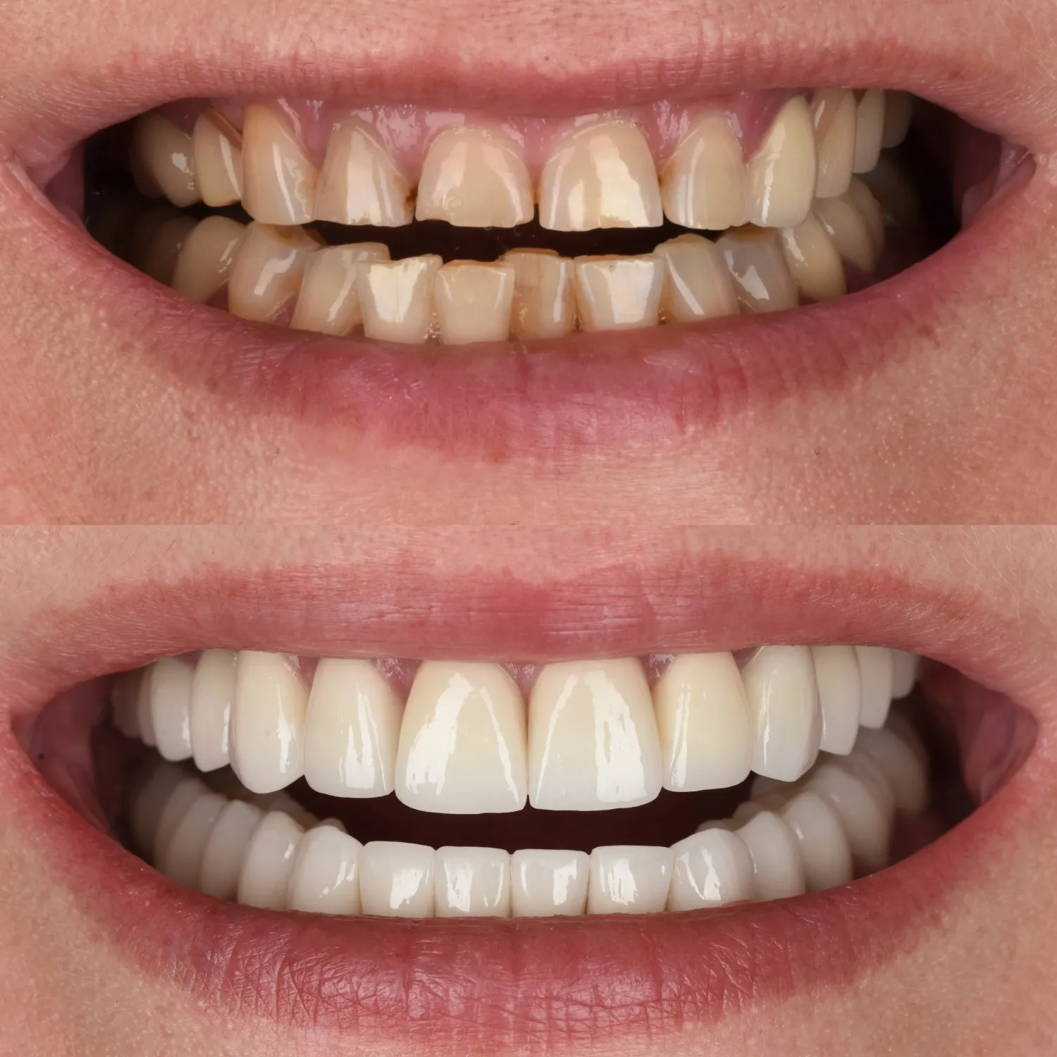 unident-union-metamorfozy-implantologia-3