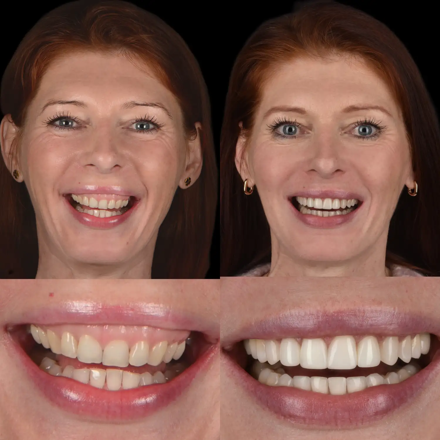 Leczenie periodontologiczne w Unident Union – nowoczesne metody walki z chorobami dziąseł i paradontozą.