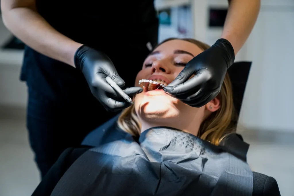 Czy bonding utrudnia leczenie ortodontyczne?