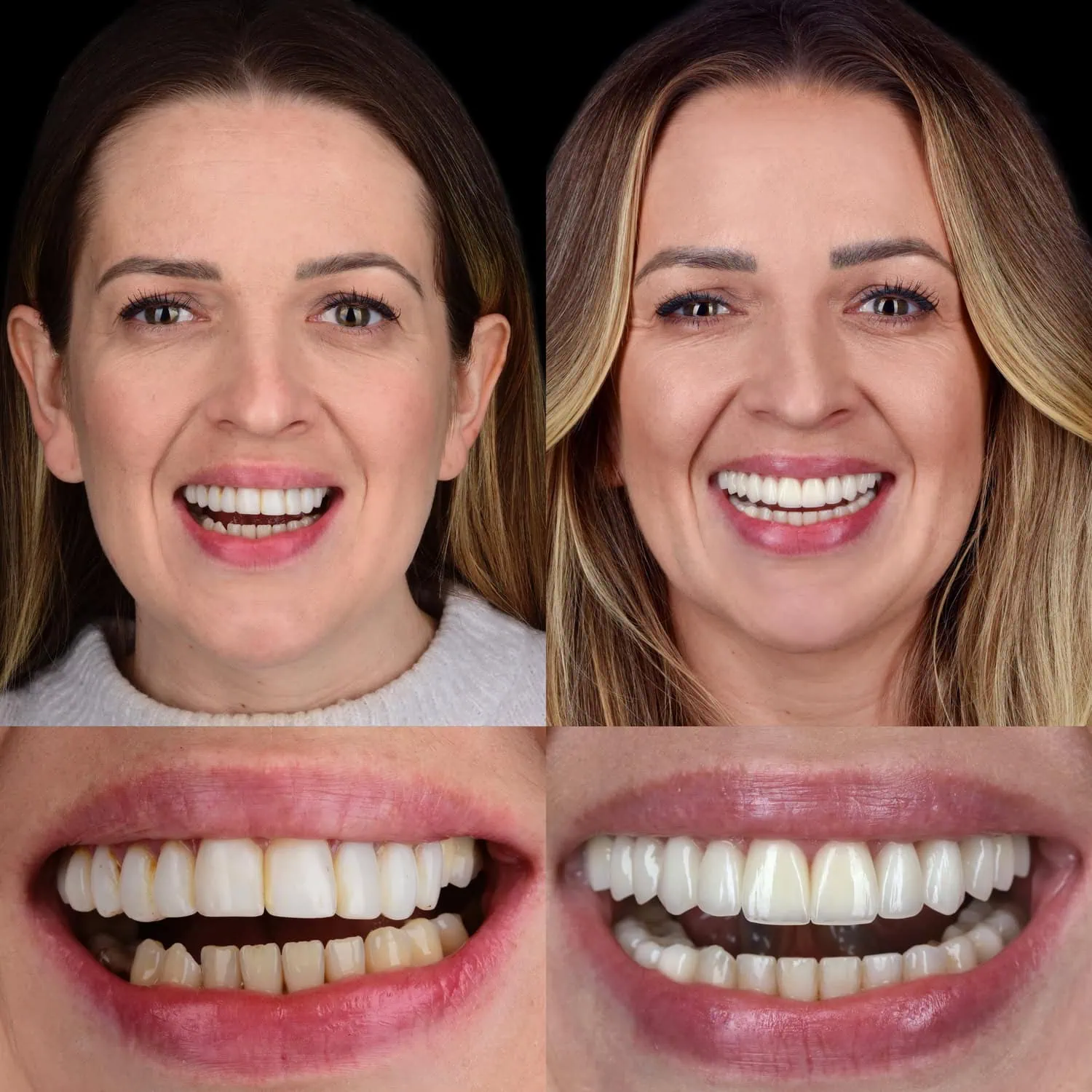 Unident-Union-metamorfoza