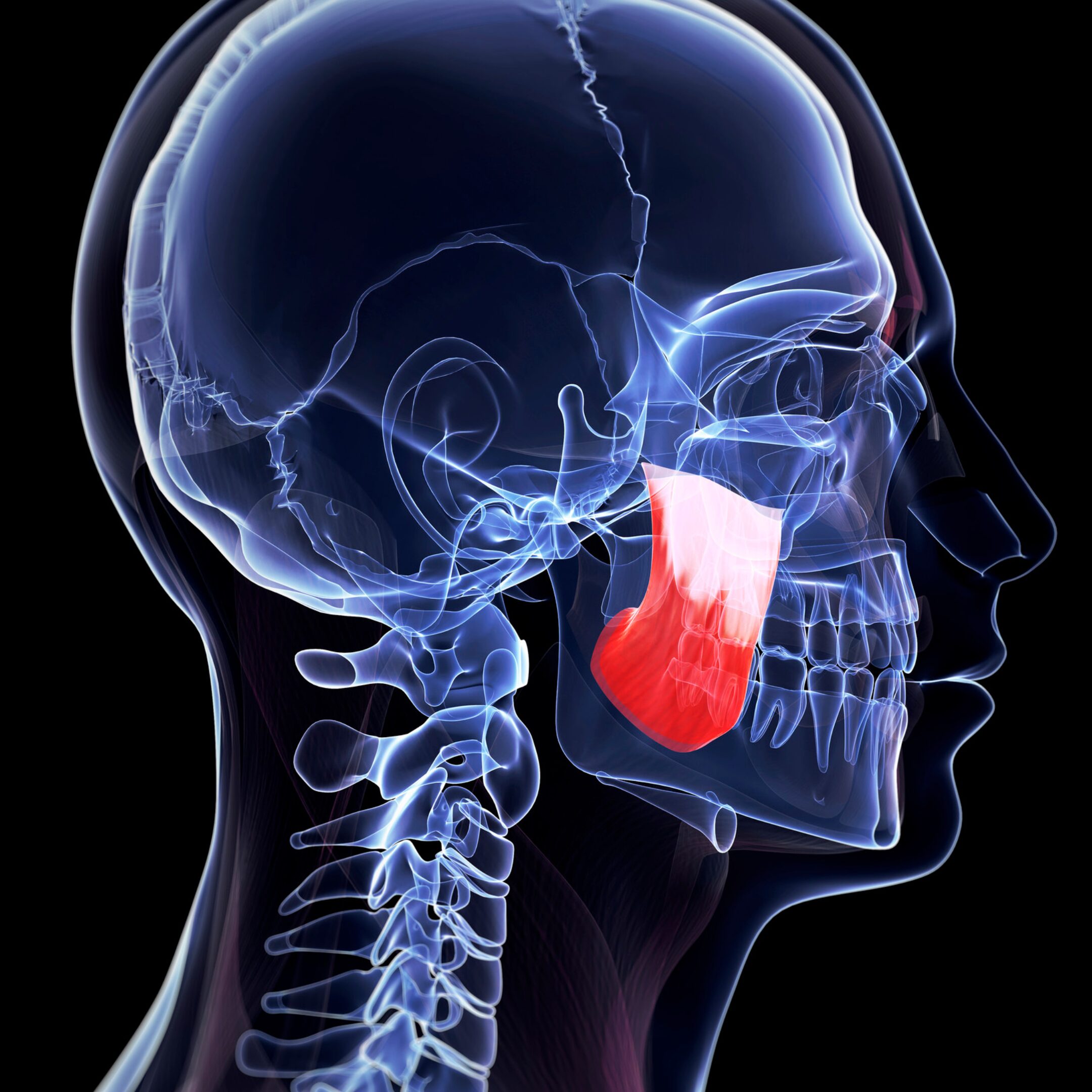 Terapia bruksizmu – połączenie iniekcji toksyny botulinowej z manualną pracą osteopatyczną w okolicy żuchwy