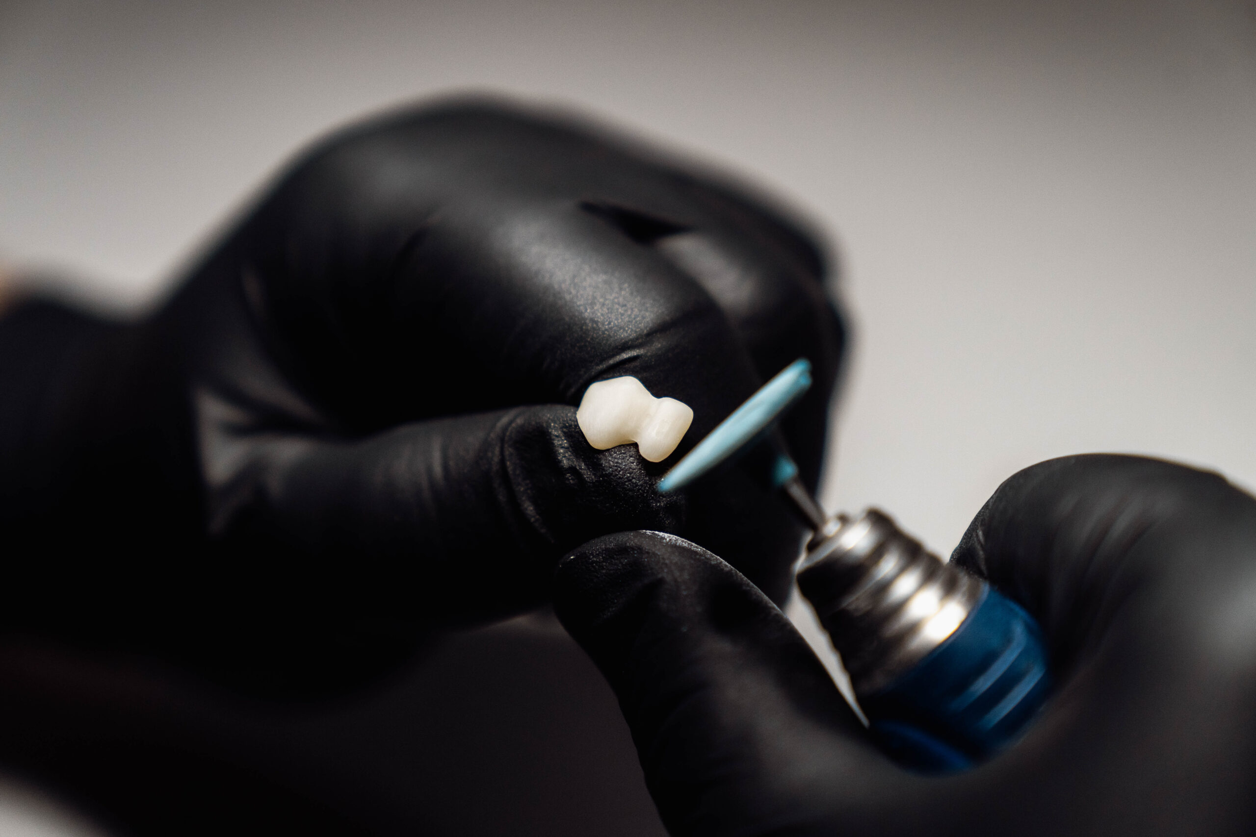 Osoba w czarnych rękawiczkach trzyma koronę dentystyczną, używając narzędzia dentystycznego do jej wypolerowania, pokazując precyzję związaną z metamorfozą uśmiechu na rozmytym białym tle.