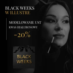 MODELOWANIE UST - Kwas hialuronowy – efekt WOW w wersji premium