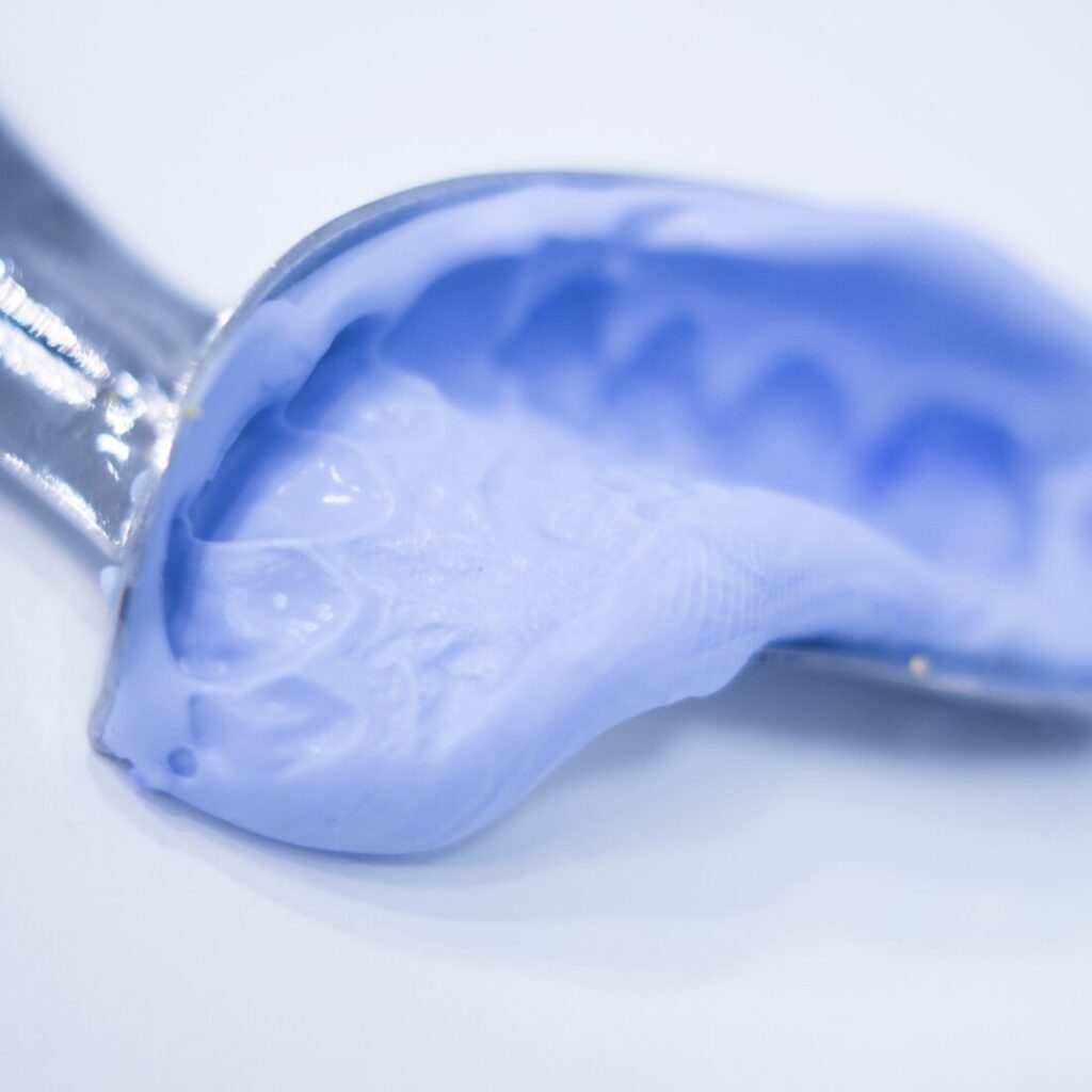 Tradycyjny wycisk dentystyczny wykonany z masy wyciskowej