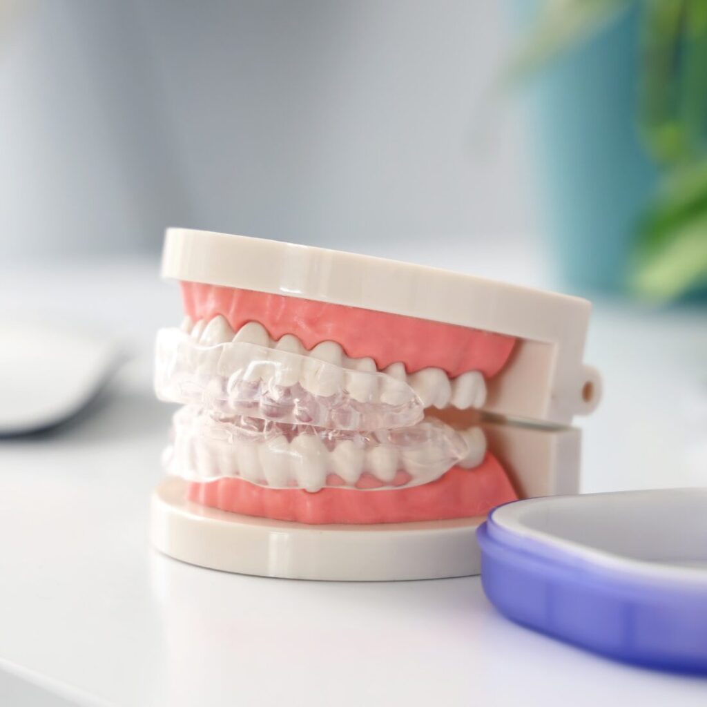 Pacjent z bruksizmem podczas leczenia ortodontycznego dorosłych – skuteczne leczenie bruksizmu aparatem ortodontycznym w Unident Union Wrocław