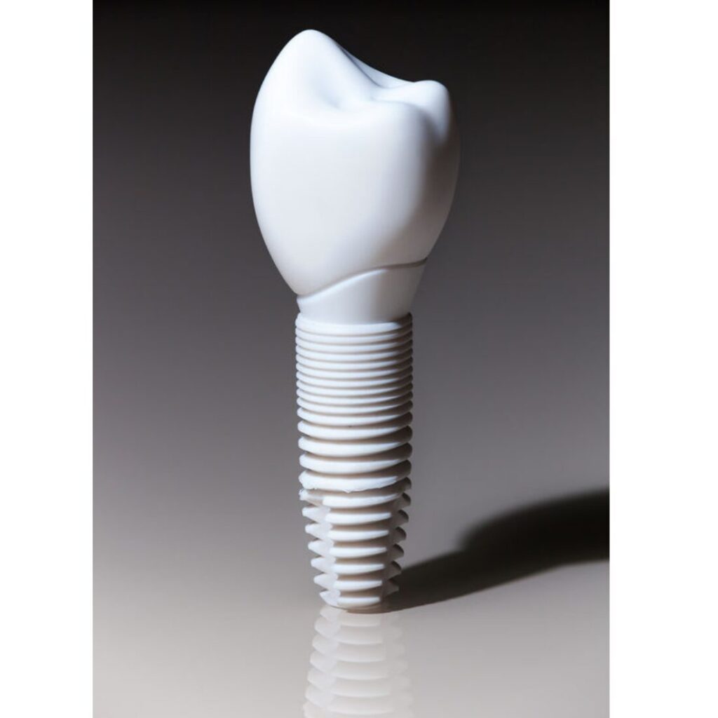 Implant cyrkonowy  to nowoczesna alternatywa — całkowicie biały, bez metalu, biokompatybilny i idealny estetycznie, szczególnie w przednim odcinku łuku zębowego.