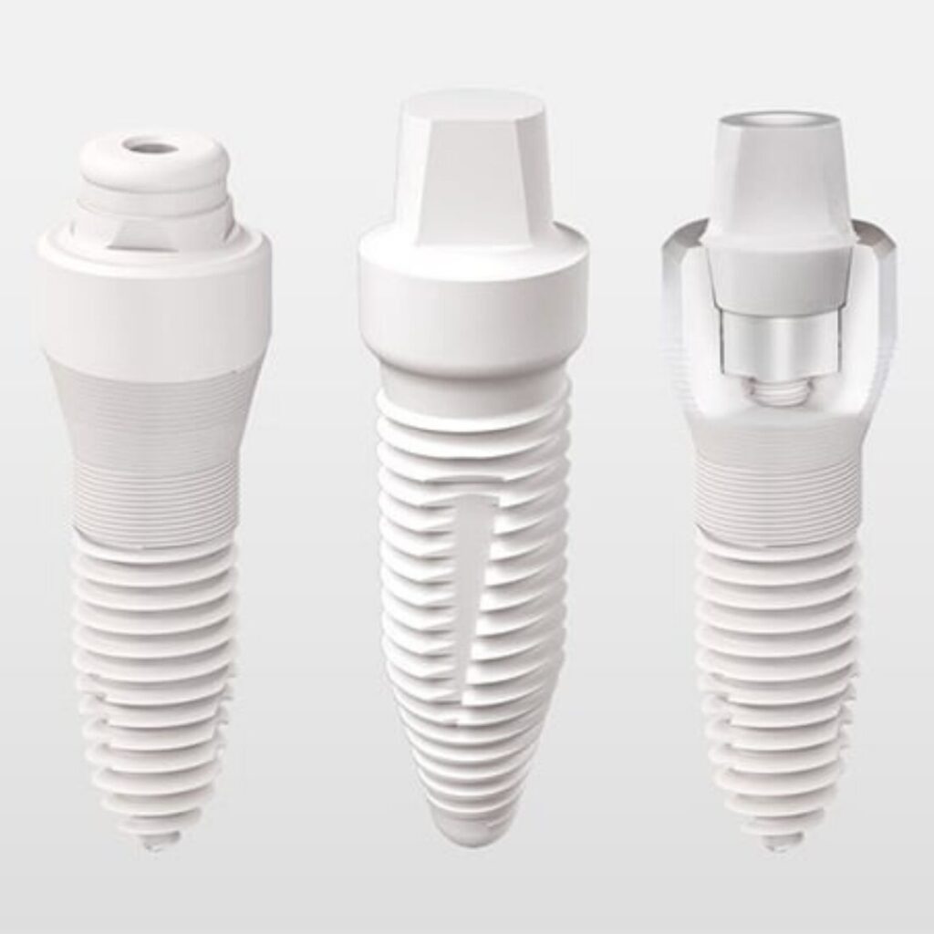 Czy implanty cyrkonowe jest lepsze?