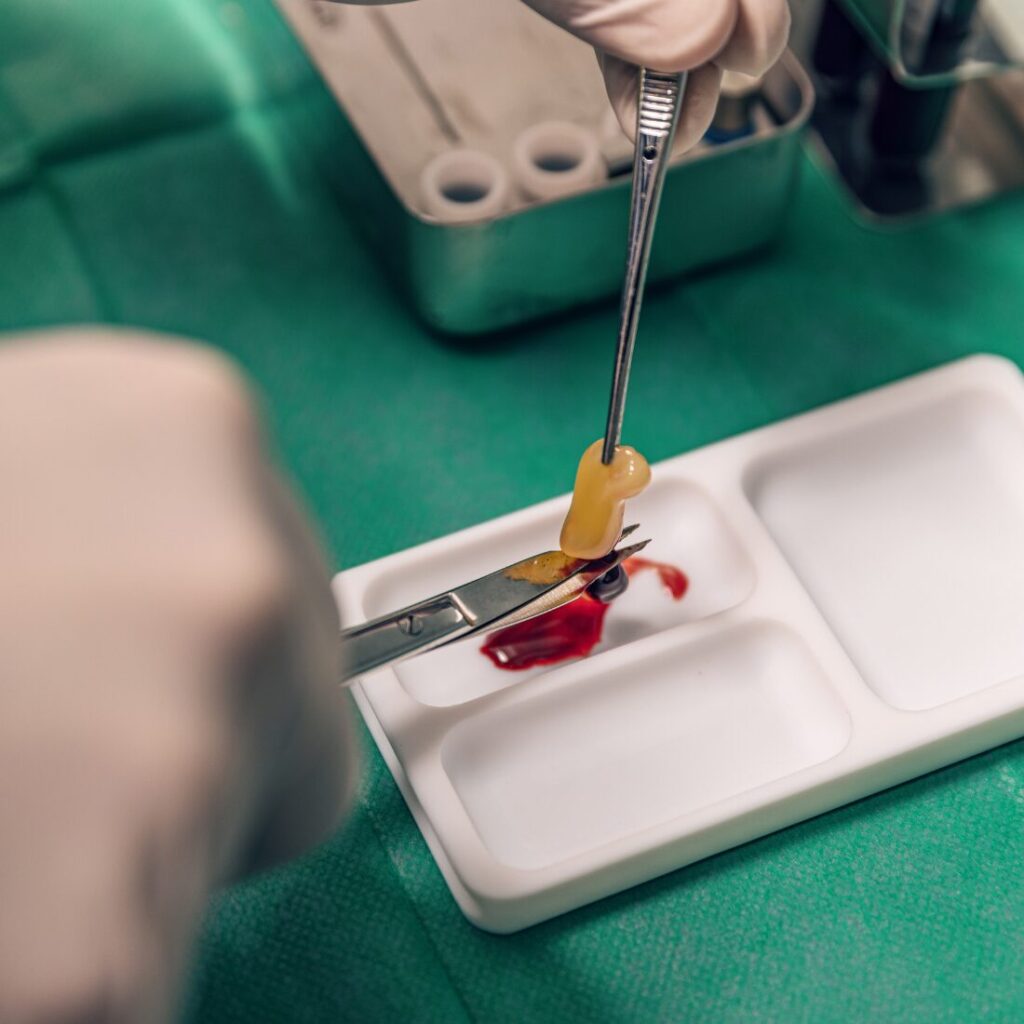 PRF w implantologii Unident Union Wrocław