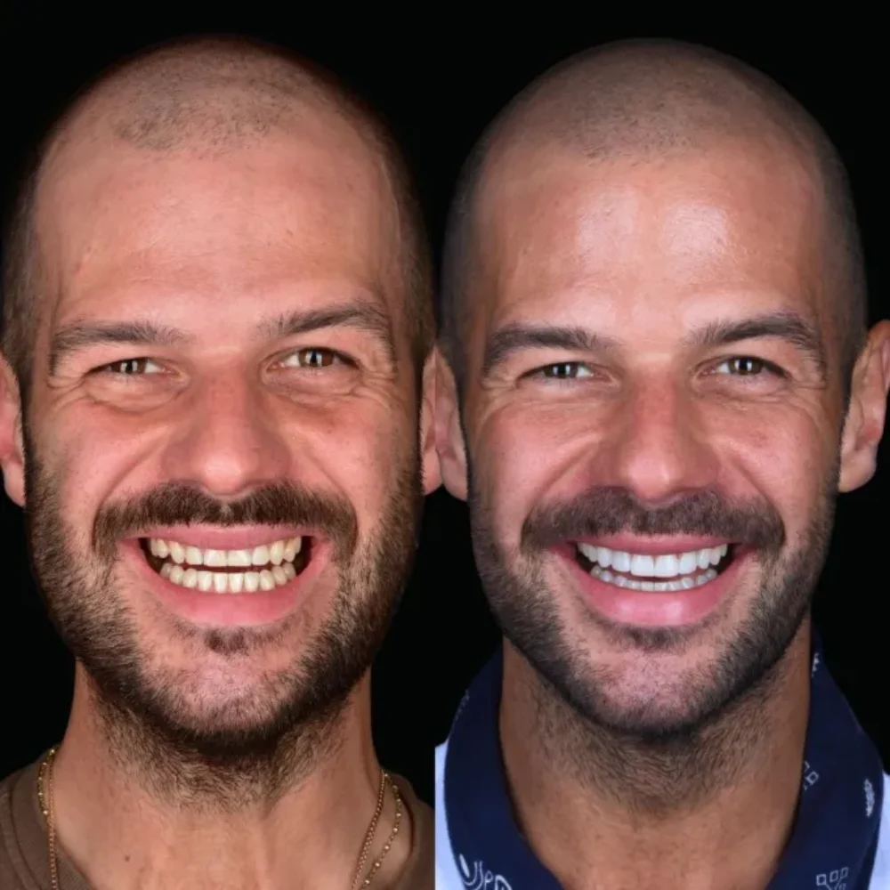 13Unident-Union-metamorfoza-