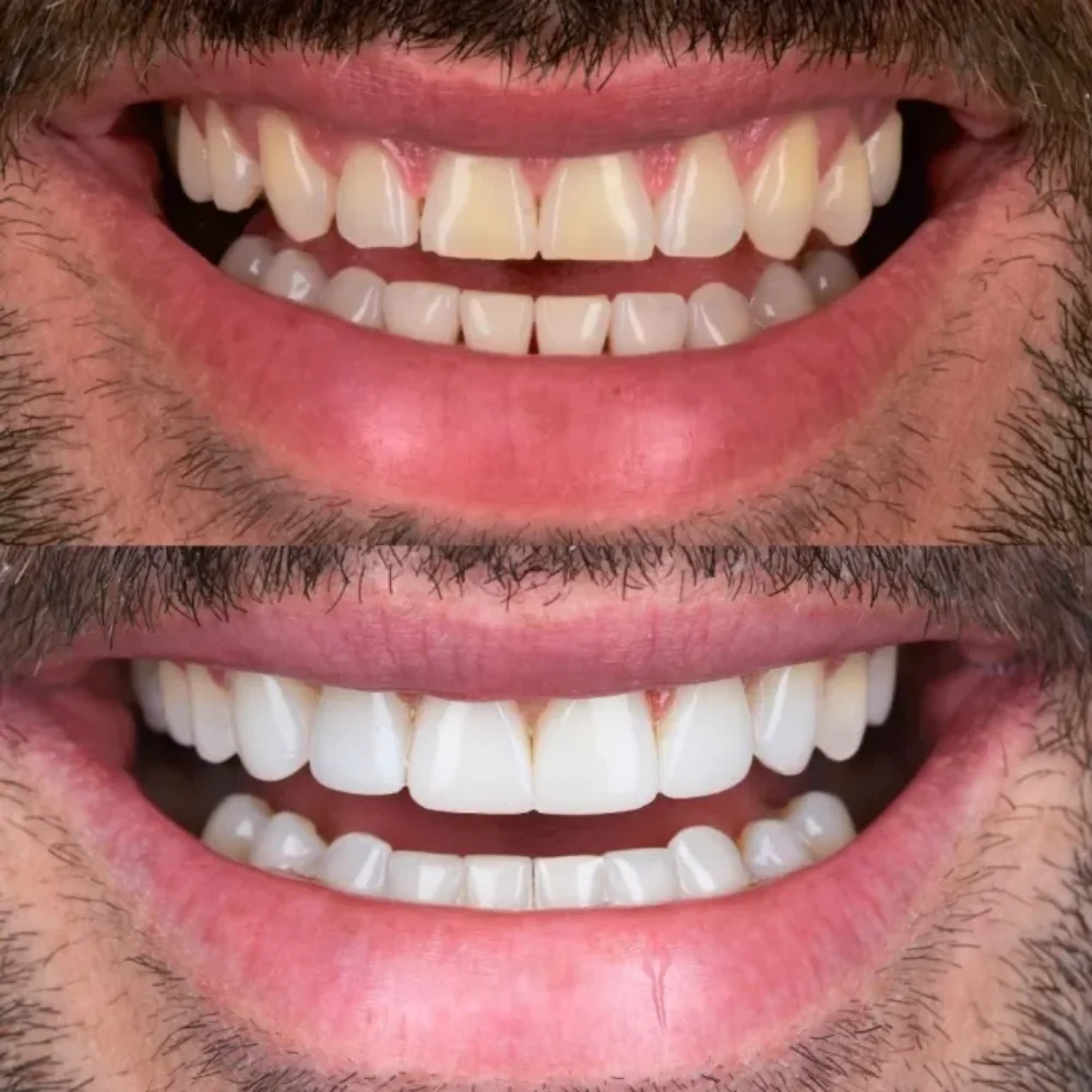 14Unident-Union-metamorfoza-