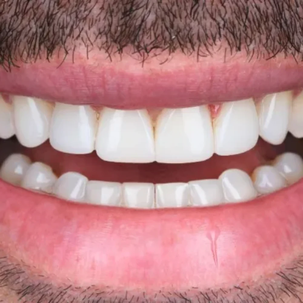 15Unident-Union-metamorfoza-