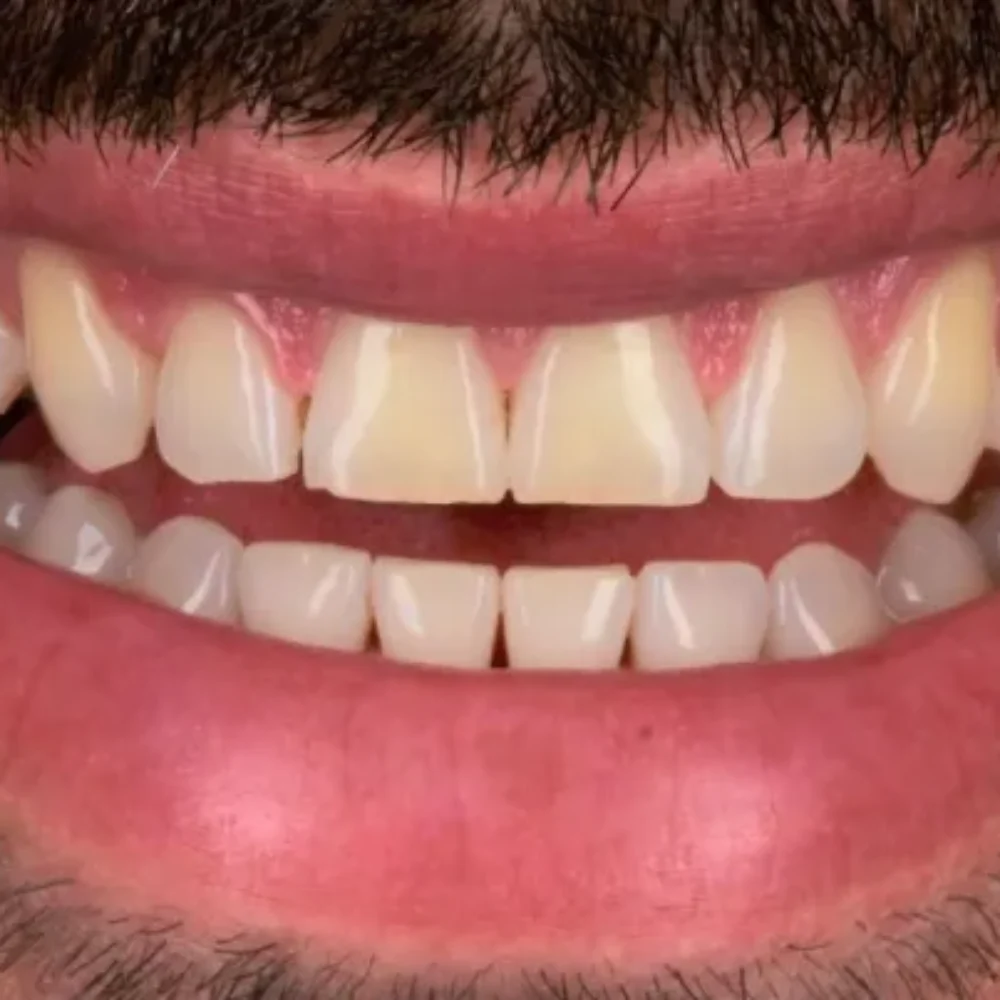 16Unident-Union-metamorfoza-