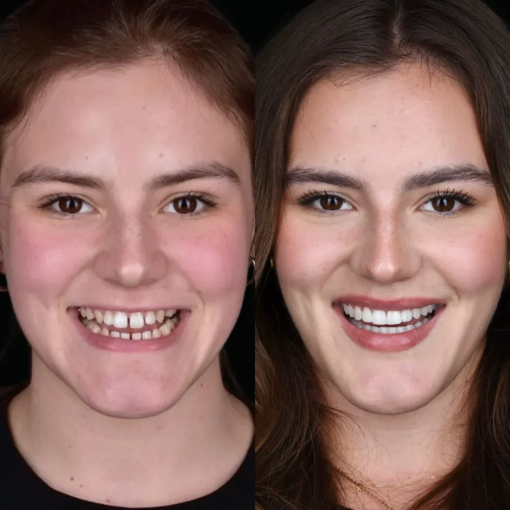 22Unident-Union-metamorfoza-