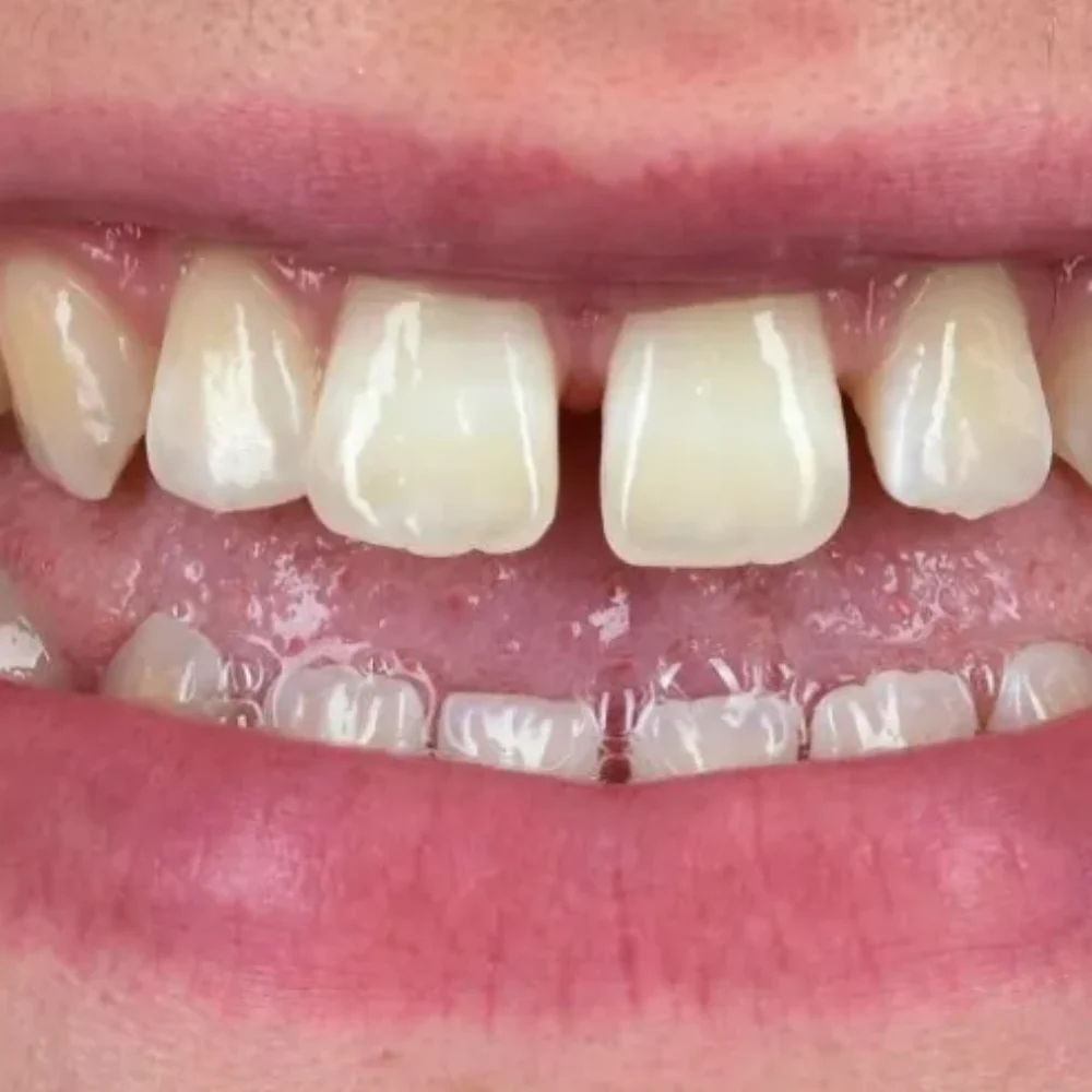 25 (1)Unident-Union-metamorfoza-