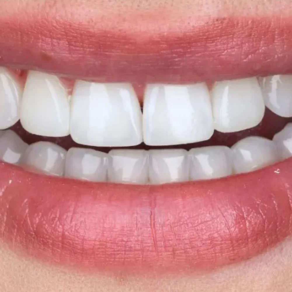 25Unident-Union-metamorfoza-