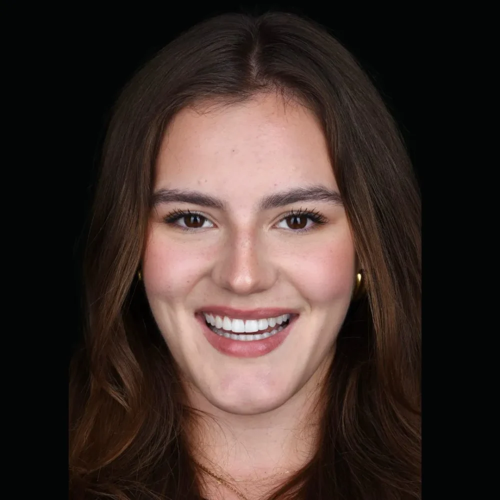 25Unident-Union-metamorfoza-