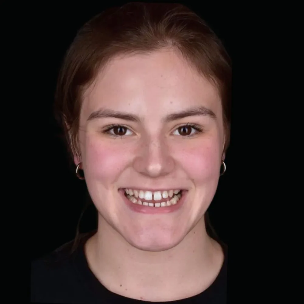 26Unident-Union-metamorfoza-