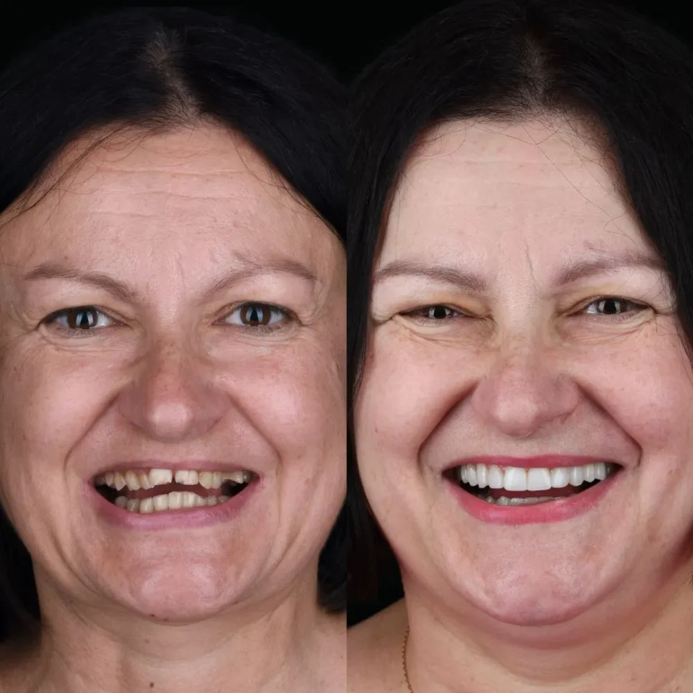 30Unident-Union-metamorfoza-Pani-Kasia-