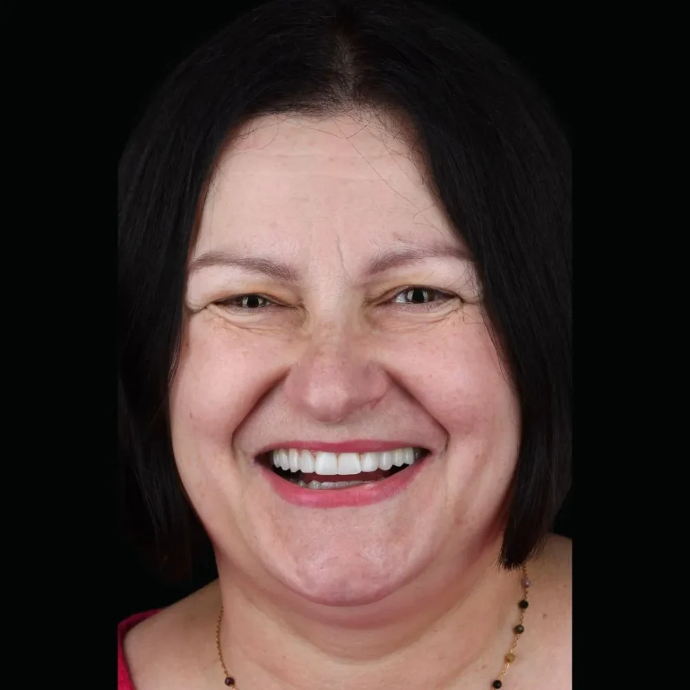 31Unident-Union-metamorfoza-Pani-Kasia-