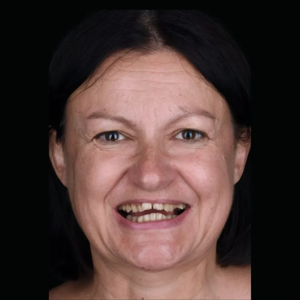 32Unident-Union-metamorfoza-Pani-Kasia-