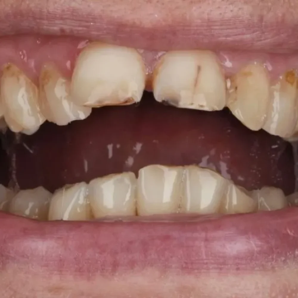 33Unident-Union-metamorfoza-Pani-Kasia-