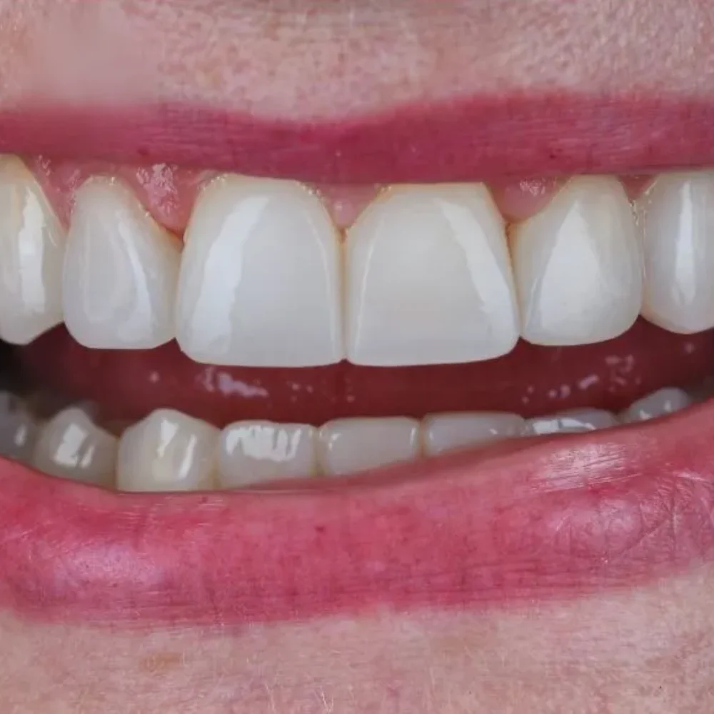 34Unident-Union-metamorfoza-Pani-Kasia-