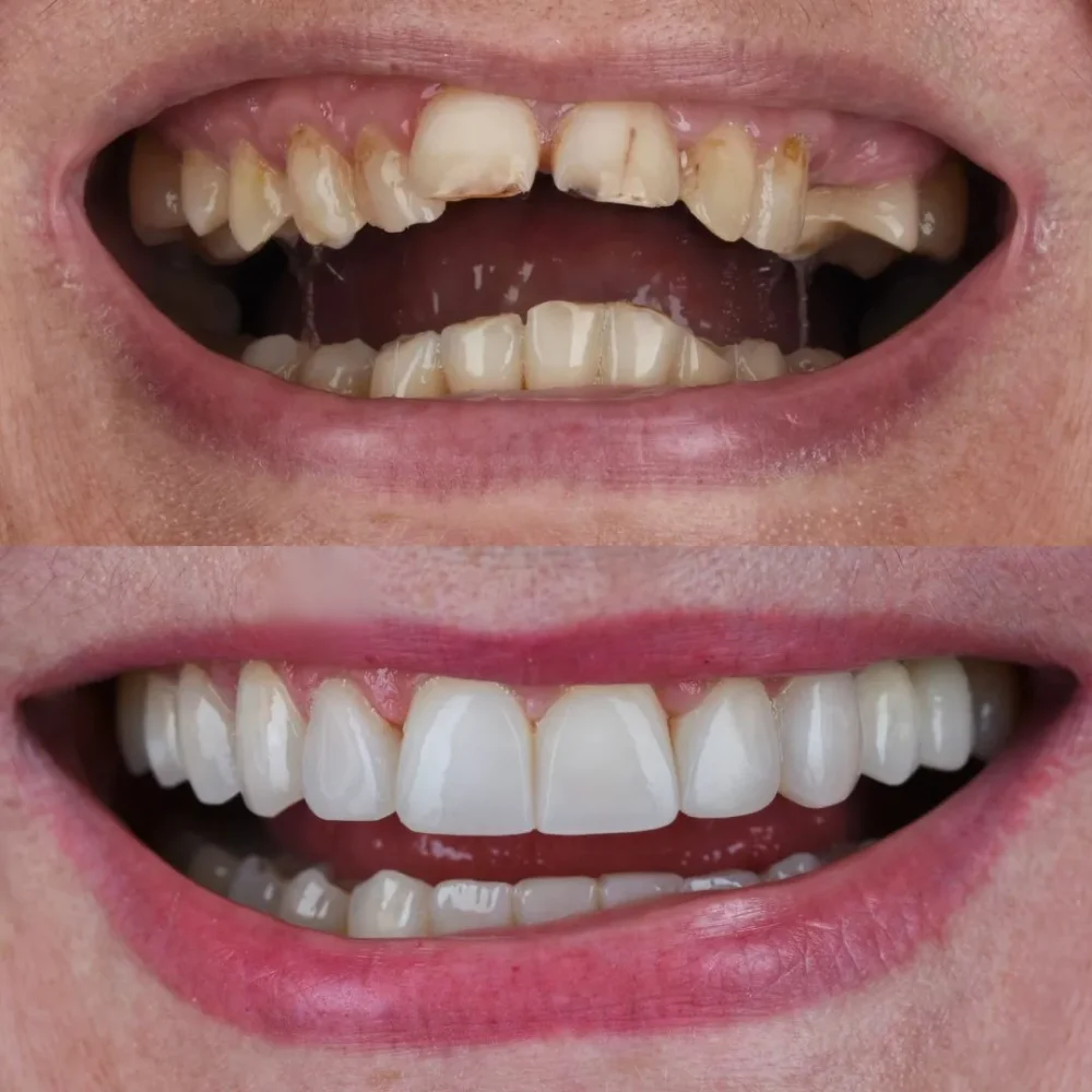 35Unident-Union-metamorfoza-Pani-Kasia-