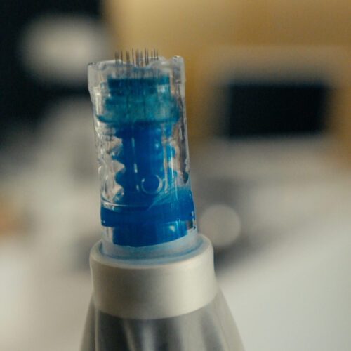 Zbliżenie niebieskiej i przezroczystej końcówki pióra do mikroigłowania z kilkoma cienkimi igłami, na rozmytym tle w pomieszczeniu - idealne dla osób poszukujących metamorfozy uśmiechu lub odkrywających ortodontę dla dorosłych Wrocław.