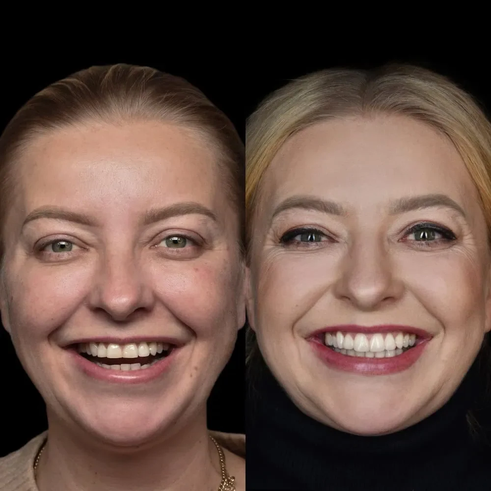Unident-Union-Metamorfozy-Cyganska-Katarzyna (6)