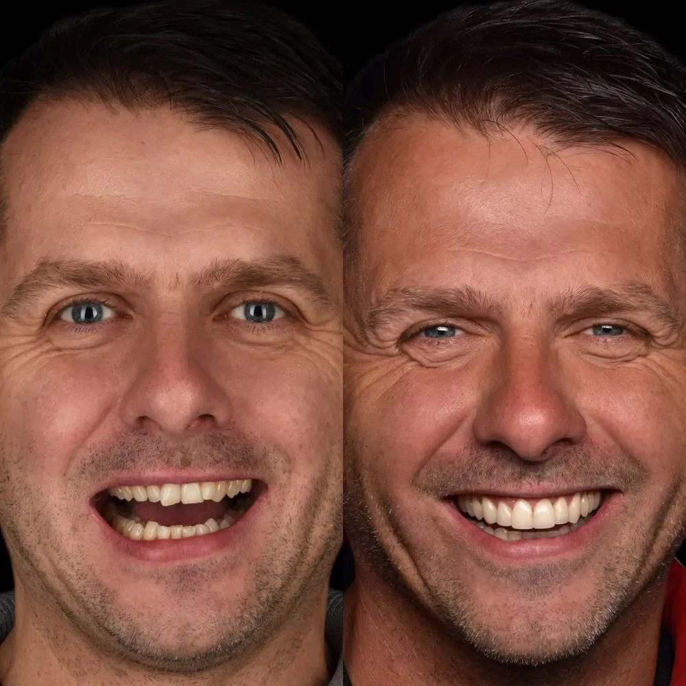 Unident-Union-Metamorfozy-Krzysztof-Blazowski (2)