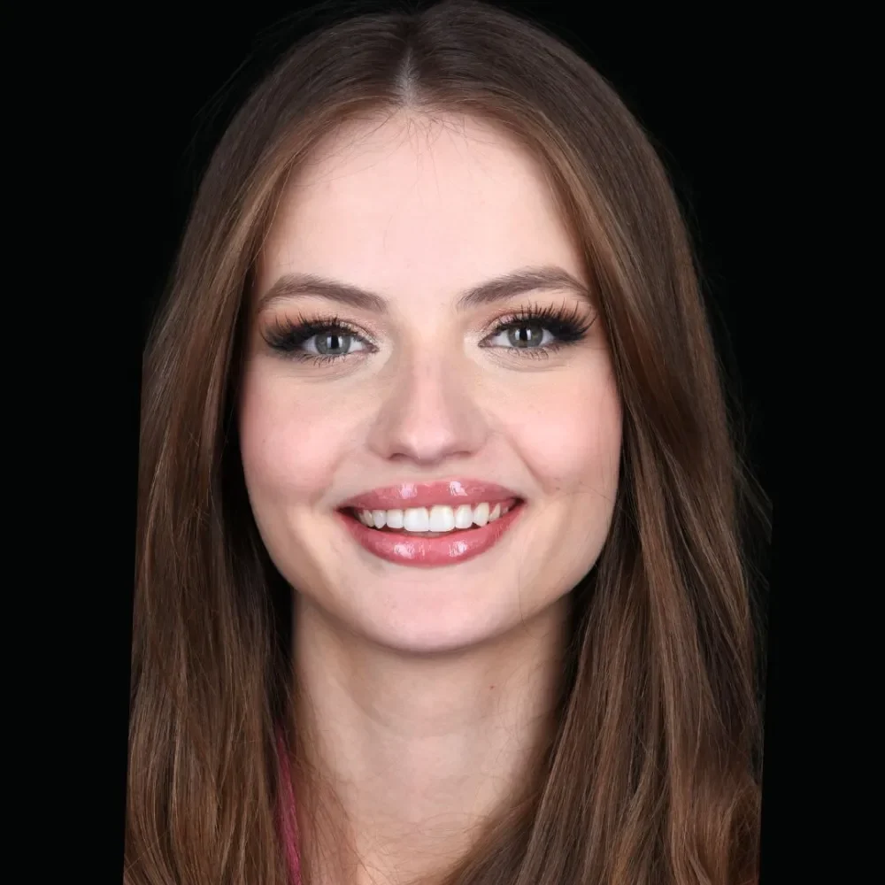 Unident-Union-metamorfoza-17