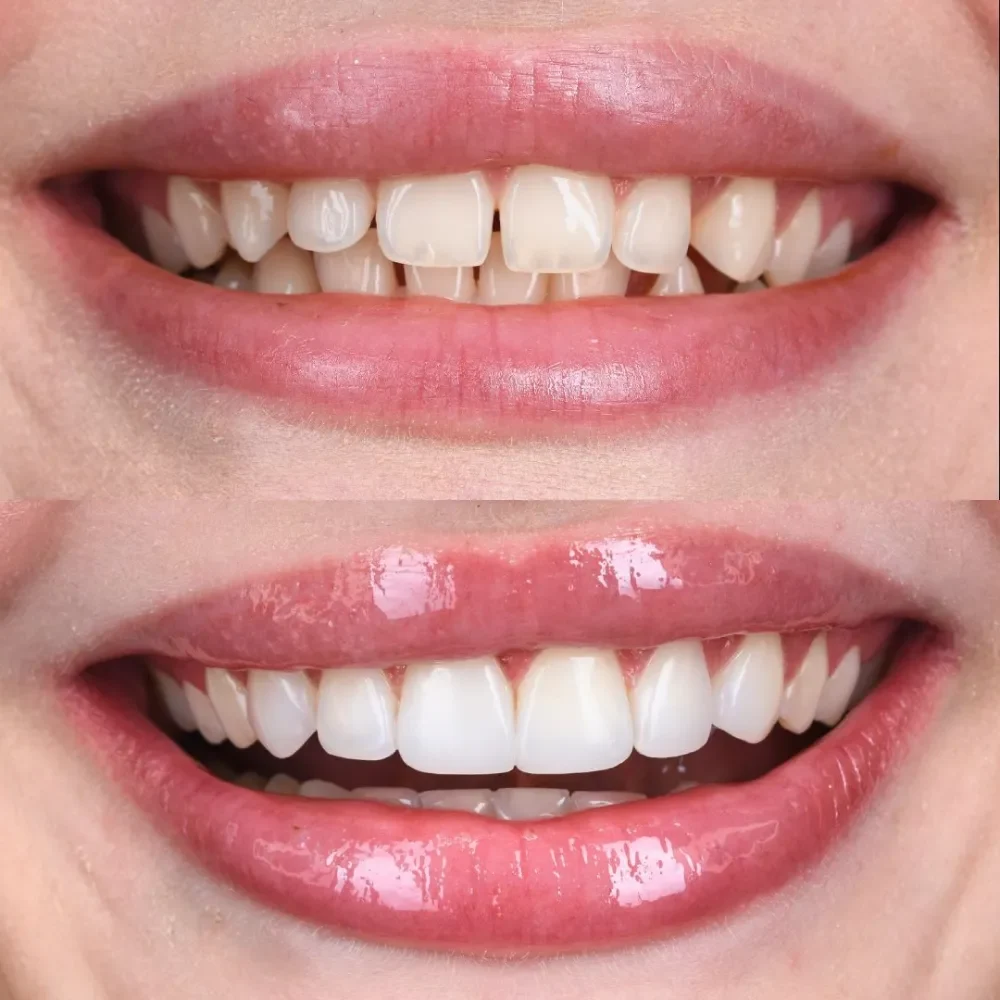 Unident-Union-metamorfoza-18