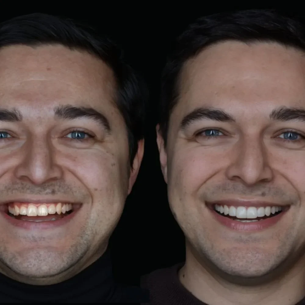 Unident-Union-metamorfoza-2