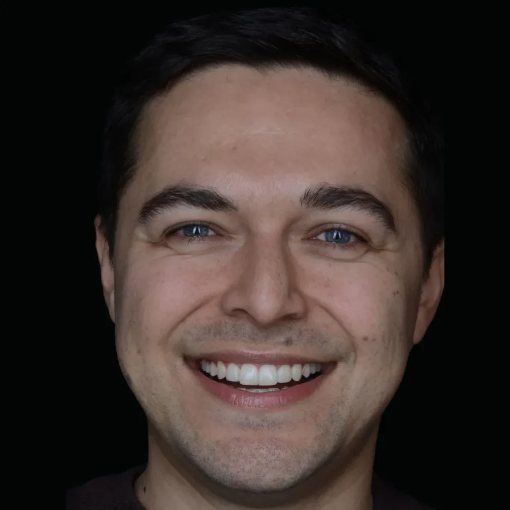 Unident-Union-metamorfoza-4