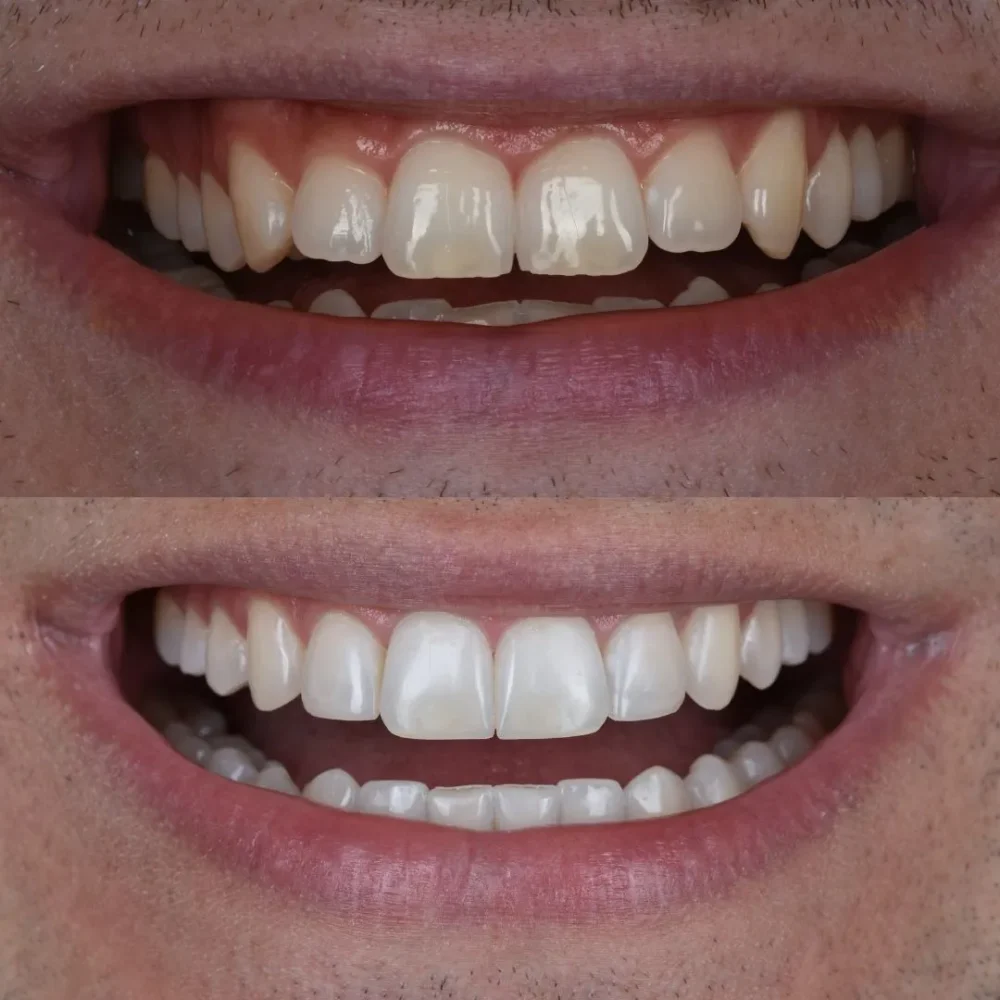 Unident-Union-metamorfoza-5