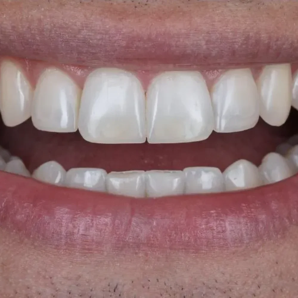 Unident-Union-metamorfoza-506355056