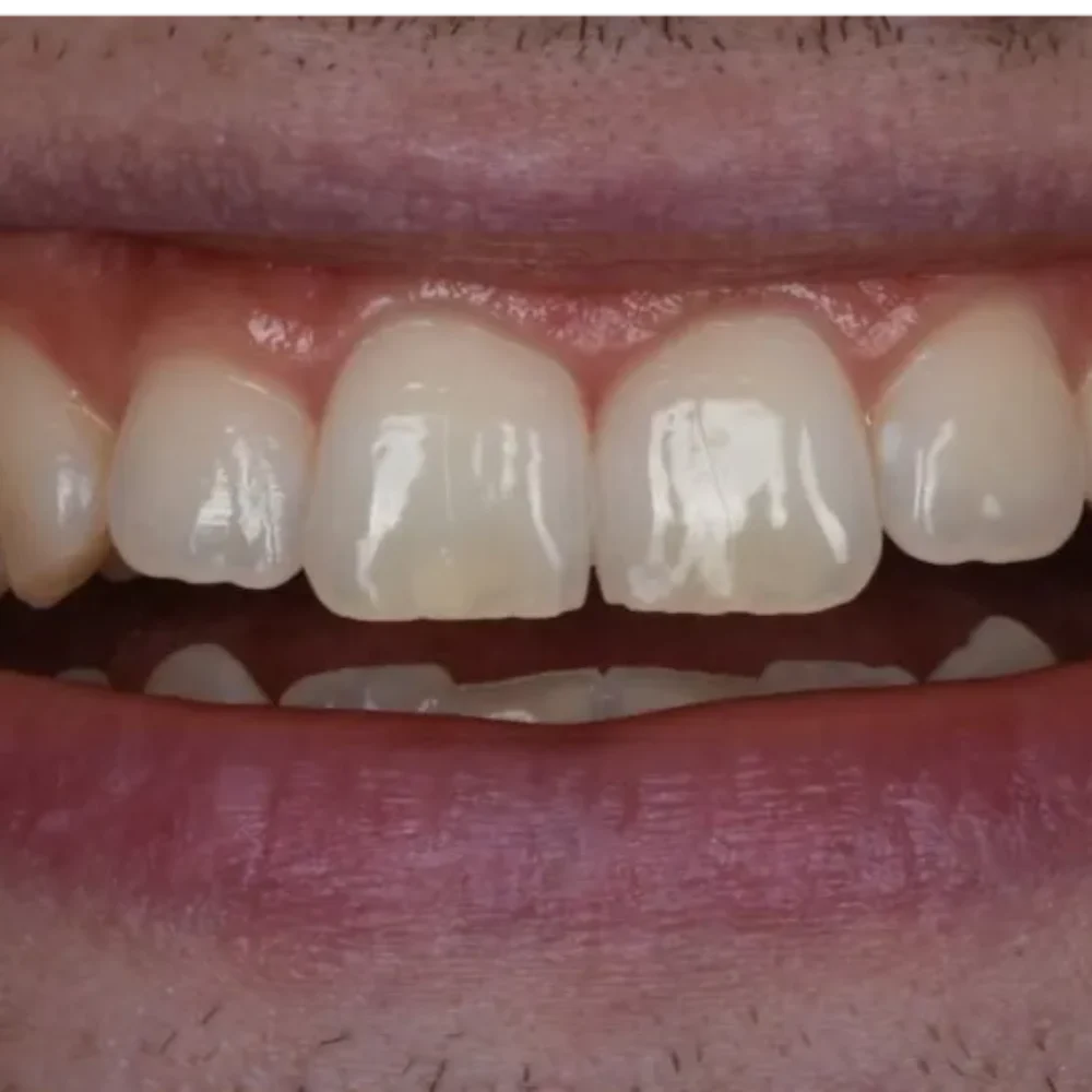 Unident-Union-metamorfoza-506355057