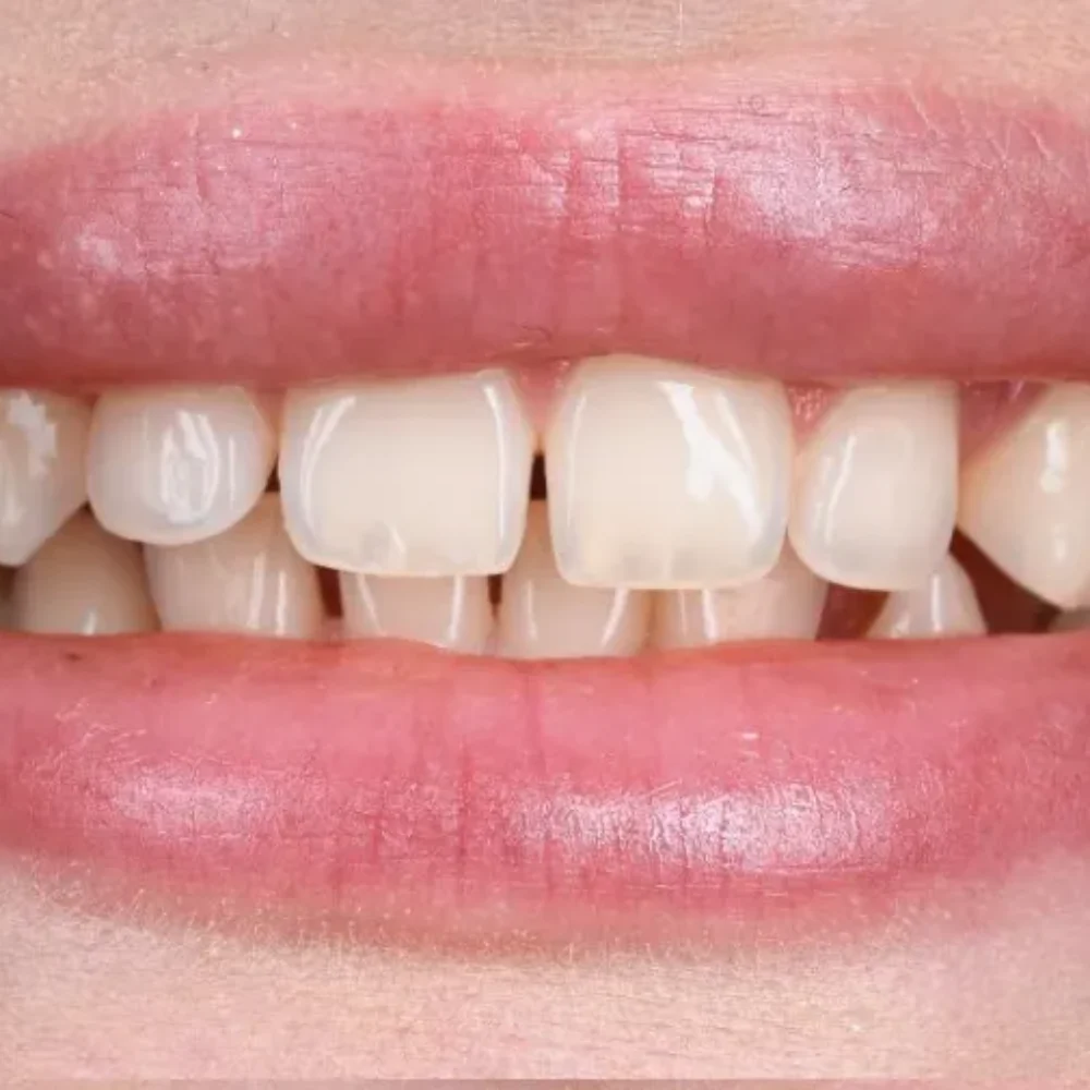 Unident-Union-metamorfoza-506355058