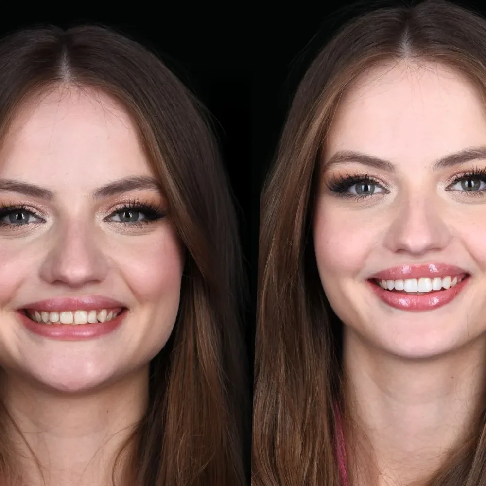 Unident-Union-metamorfoza-frame-174