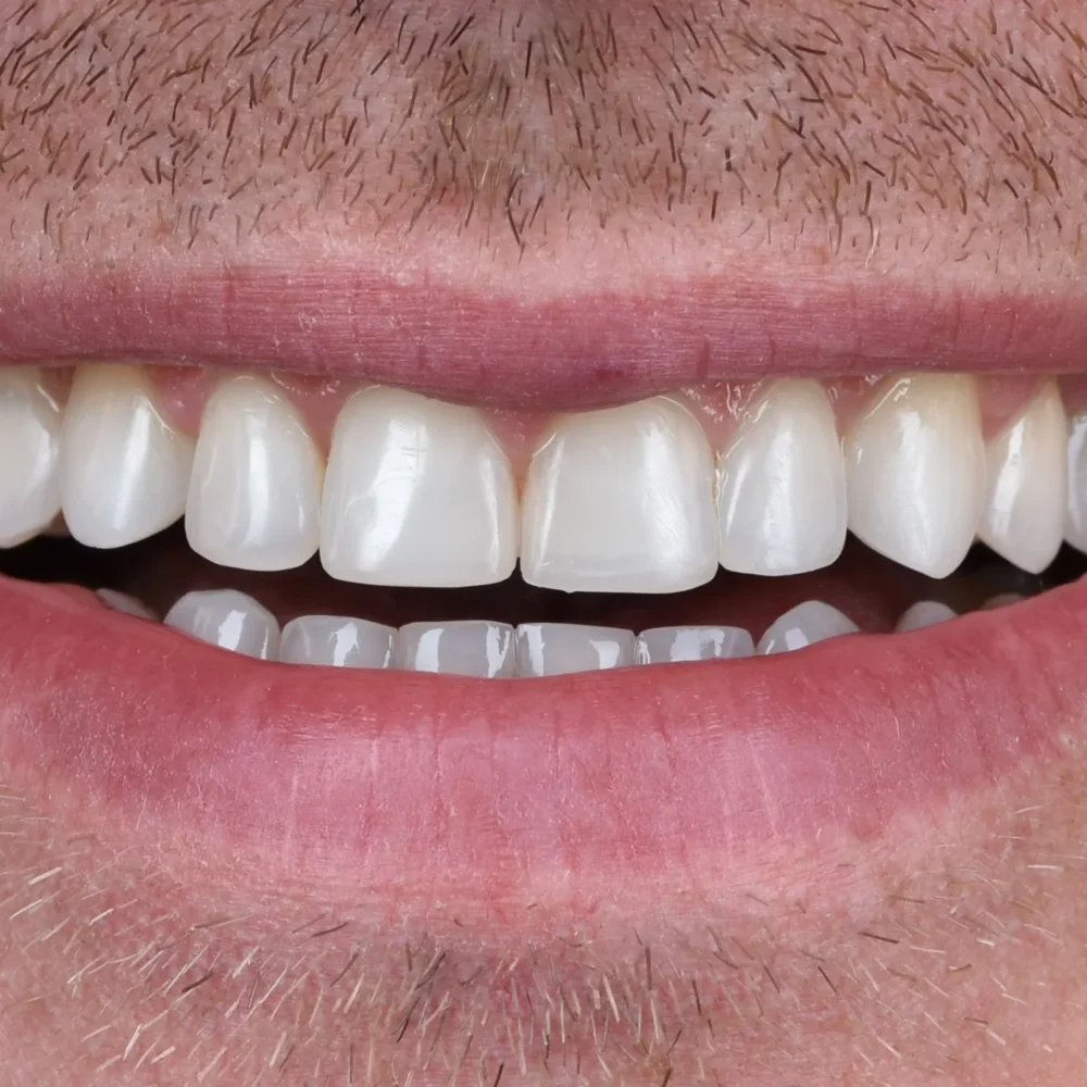 Unident-Union-metamorfoza-usmiechu-dsc-2258-1