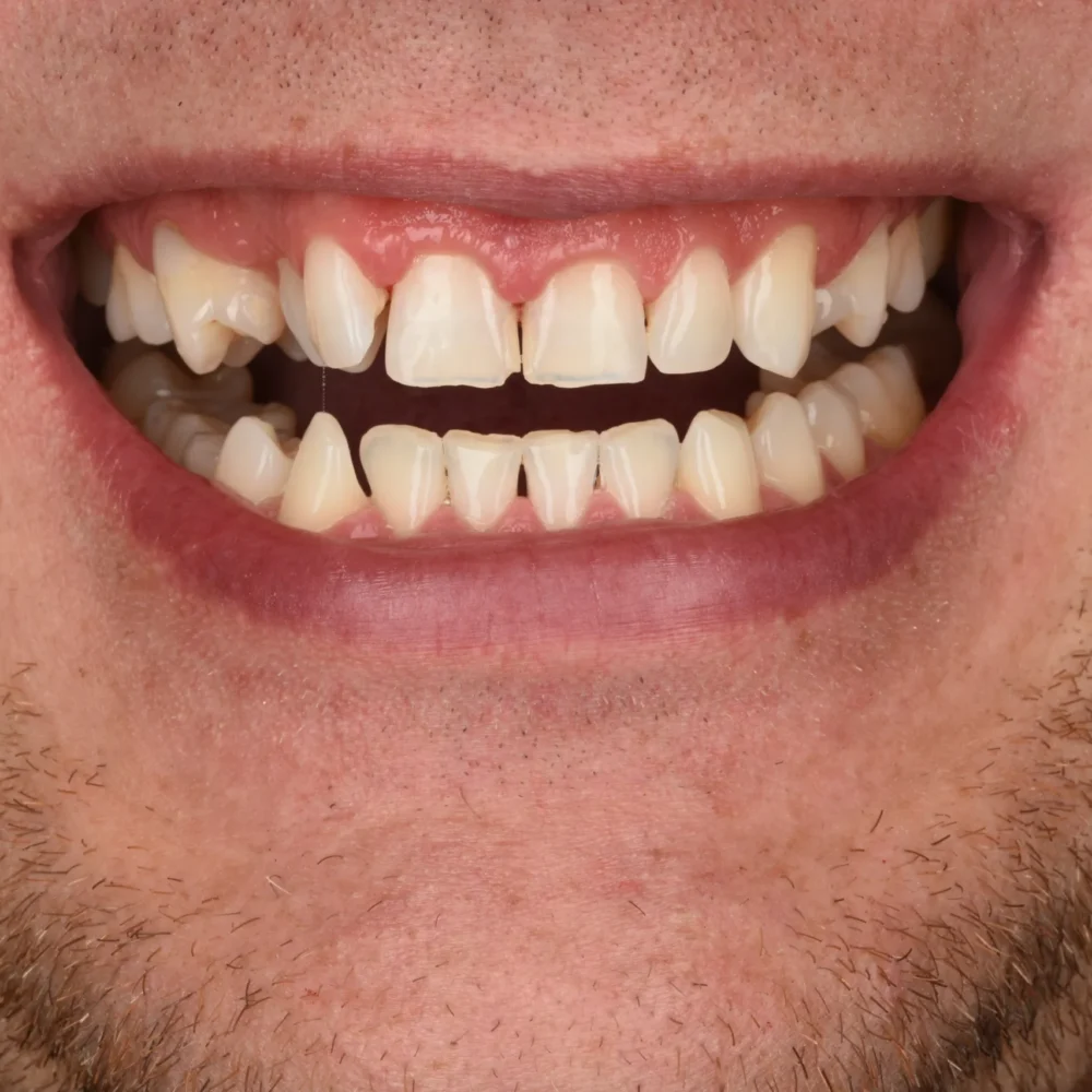 Unident-Union-metamorfoza-usmiechu-dsc-9858-1