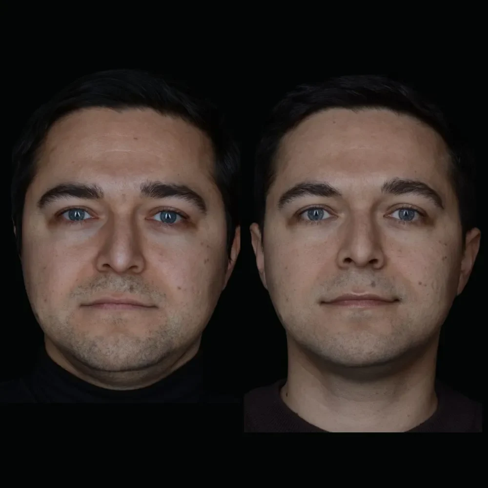 Unident-Union-metamorfoza-zdje-cia-przed-po-1