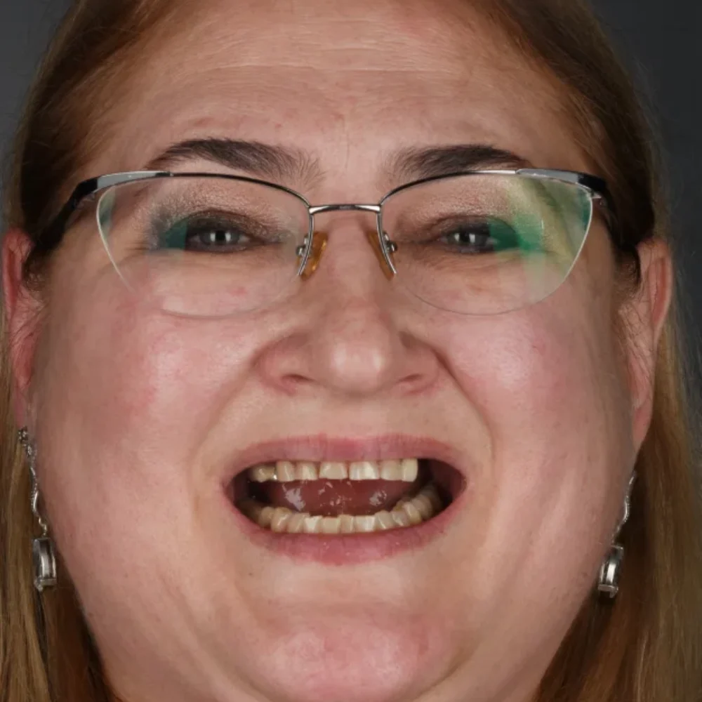 Unident-union-metamorfozy-dsc-8437-1