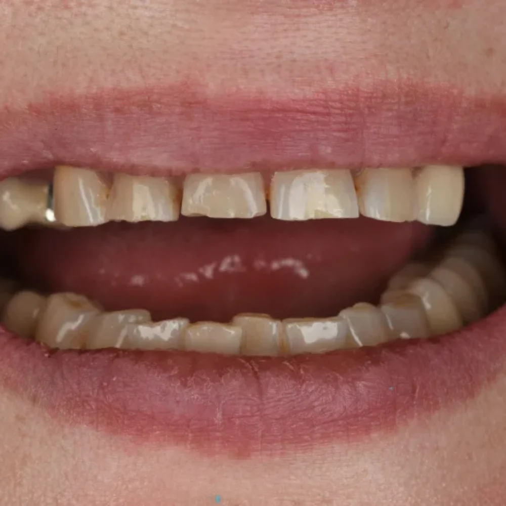 Unident-union-metamorfozy-dsc-8469-1