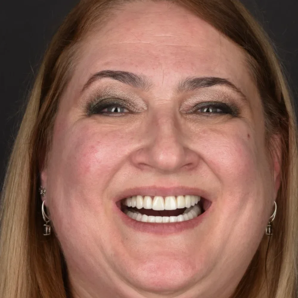 Unident-union-metamorfozy-dsc-8513-2