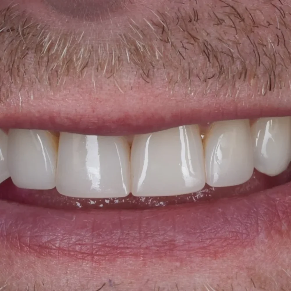 Unident-union-metamorfozy-img-2170-2