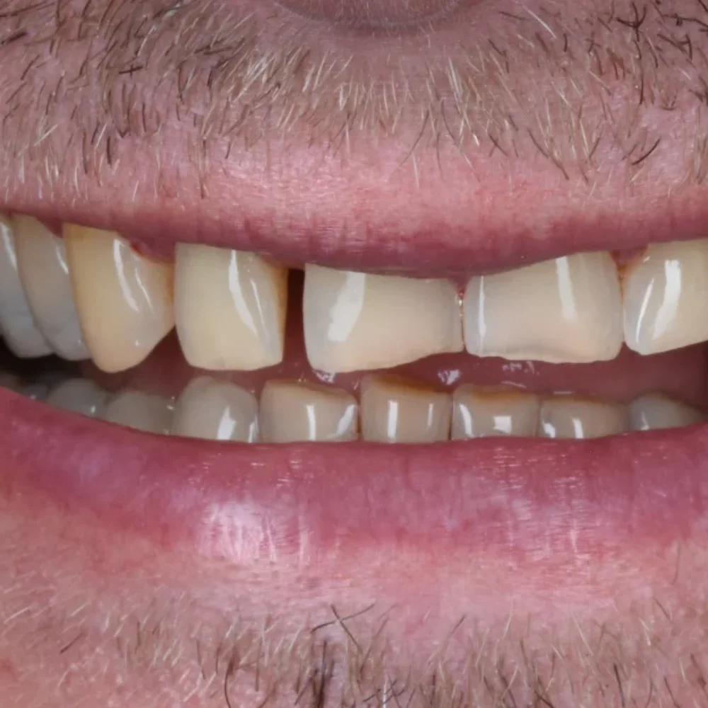 Unident-union-metamorfozy-img-2172-2