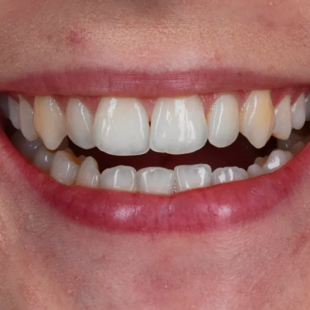 Unident-union-metamorfozy-img-7669-1